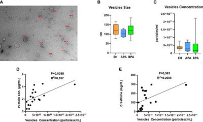 Proteomic analysis of urinary extracellular vesicles highlights specific signatures for patients with primary aldosteronism